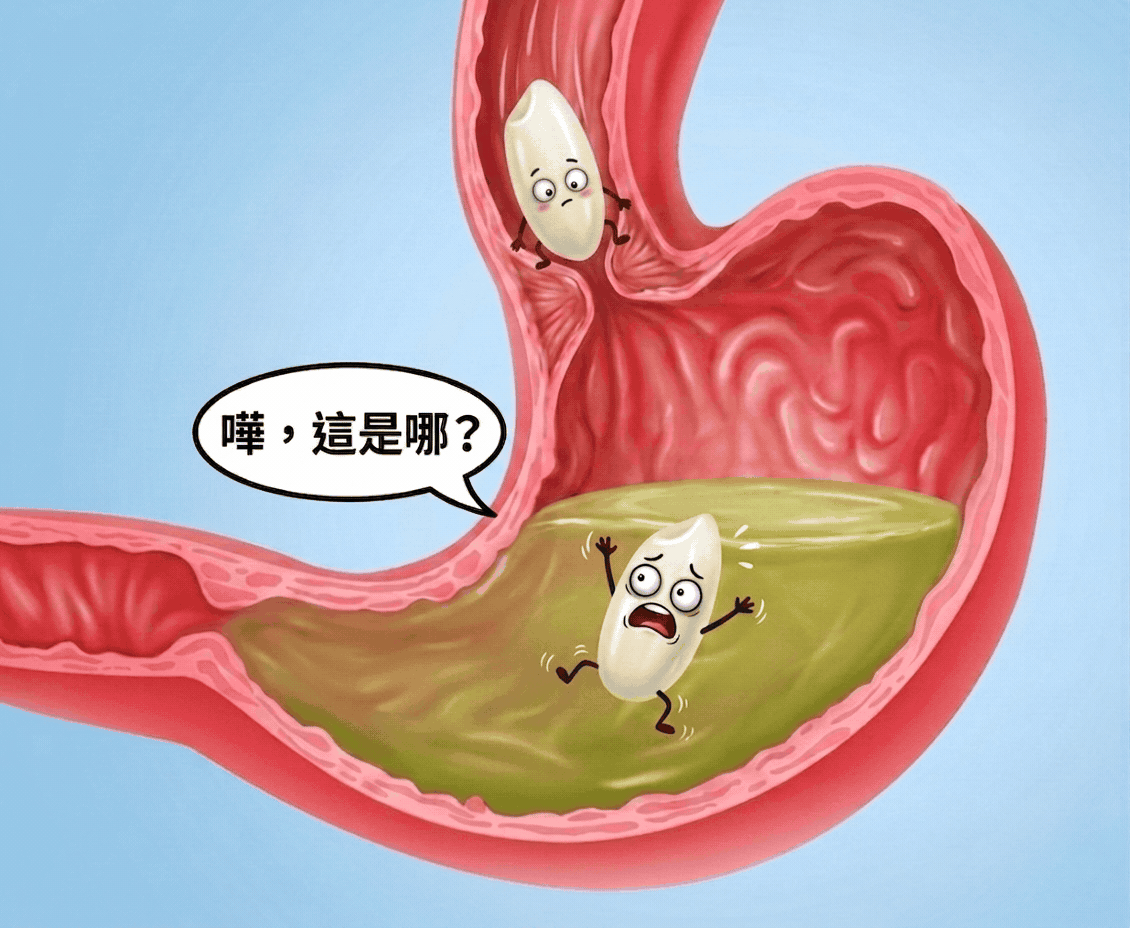 胃內引導示意圖
